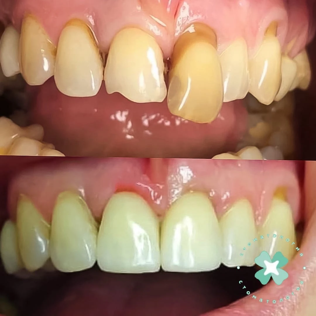 не удалось загрузить