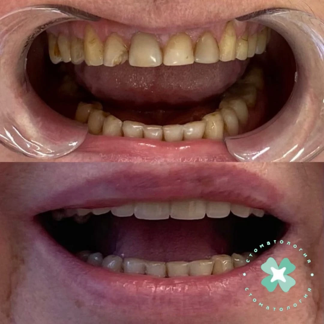 не удалось загрузить